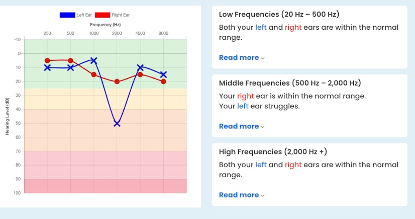 MDHearing Test Results Audiogram