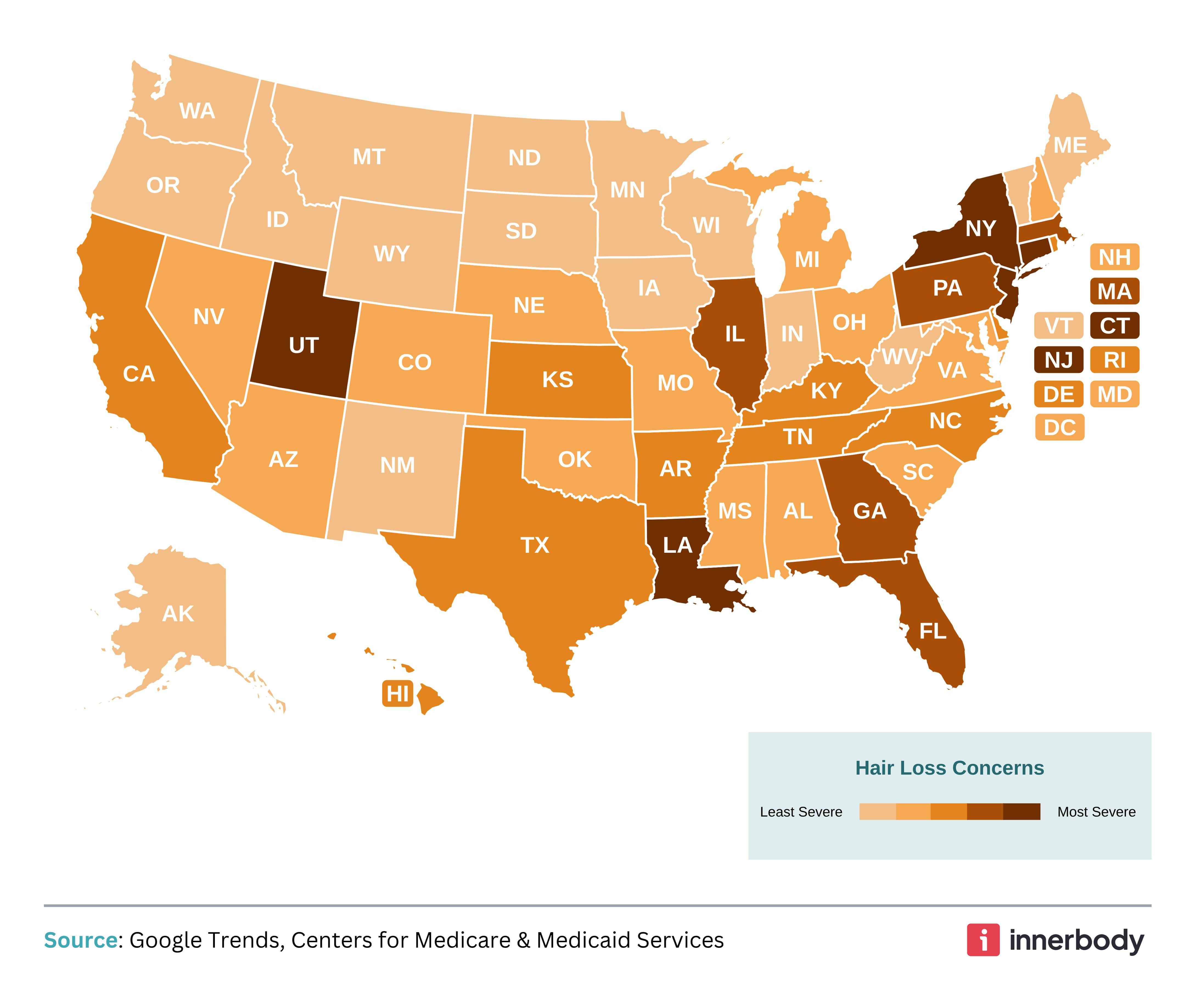 Which States Have the Biggest Problem with Hair Loss?