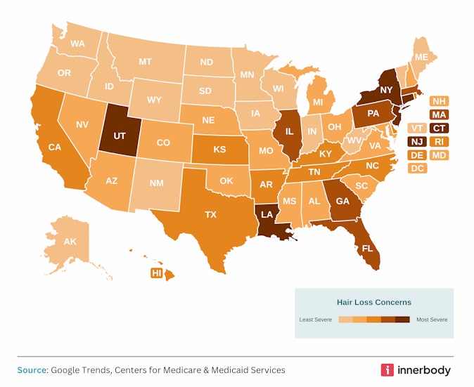 map of U.S. states based on severity of hair loss concerns