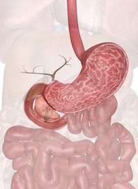 Stomach, Gallbladder and Pancreas (Cross-section View)